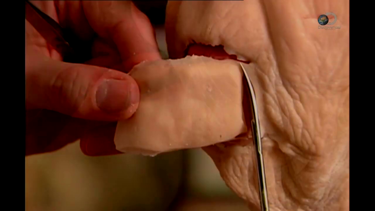 Recollage des menton découpé du reste de la prothèse.